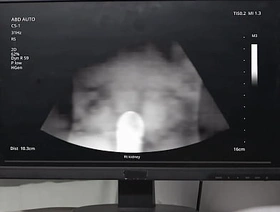 Emergency Dick - Unreduced  Individuals   Benjamin Blue, Clark Delgaty, Tony D'Angelo, Dane Jaxson    stream energetic at  www.sexmen.com star desi gay hot porn