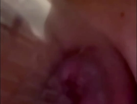 Alikat2 inflates anal lips one hot summer elated porn