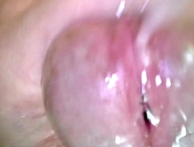 Korslaveman - Sounding around an endoscopic camera hot muscular korean gay porn